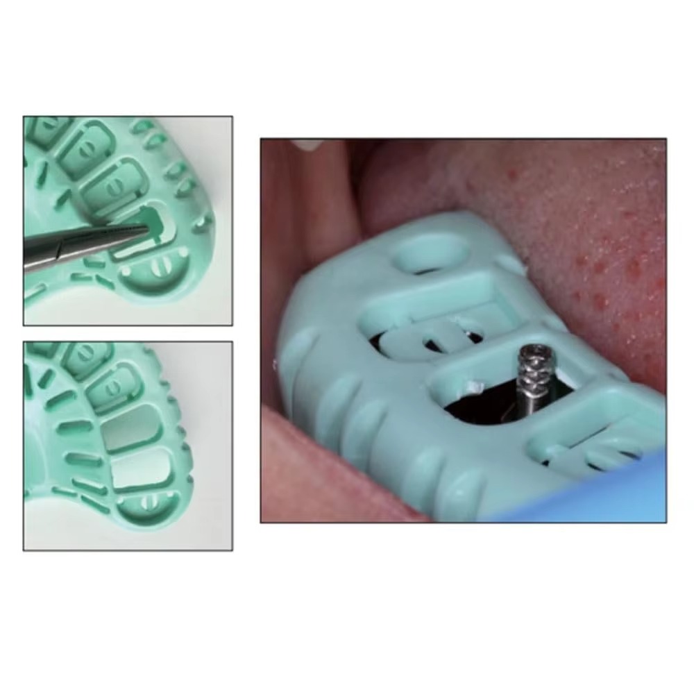 FULAIGE 6-teiliges Set Einweg- – Dental Impression Material Kit Bewertung und Preis
