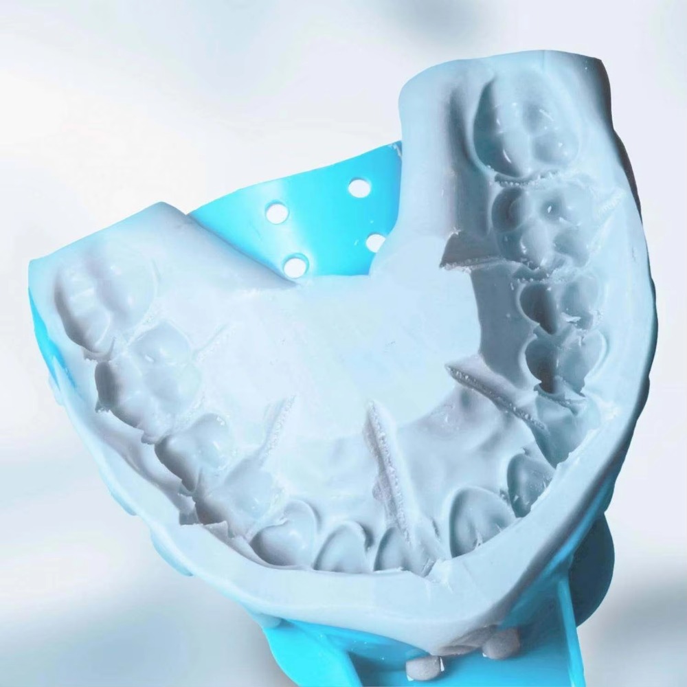 FULAIGE 6-teiliges Set Einweg- – Dental Impression Material Kit Bewertung und Preis