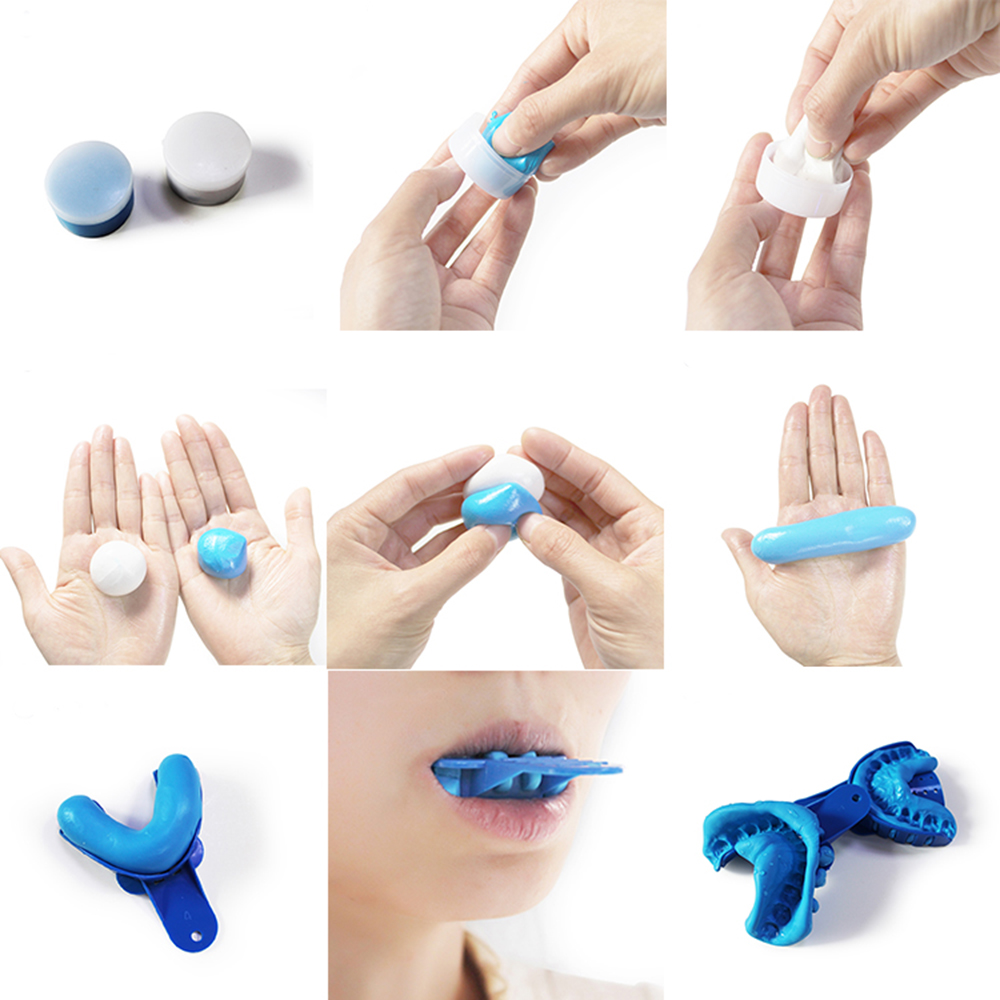 Luxsmile Dental Klinische Eind – Dental Impression Material Kit Bewertung und Preis