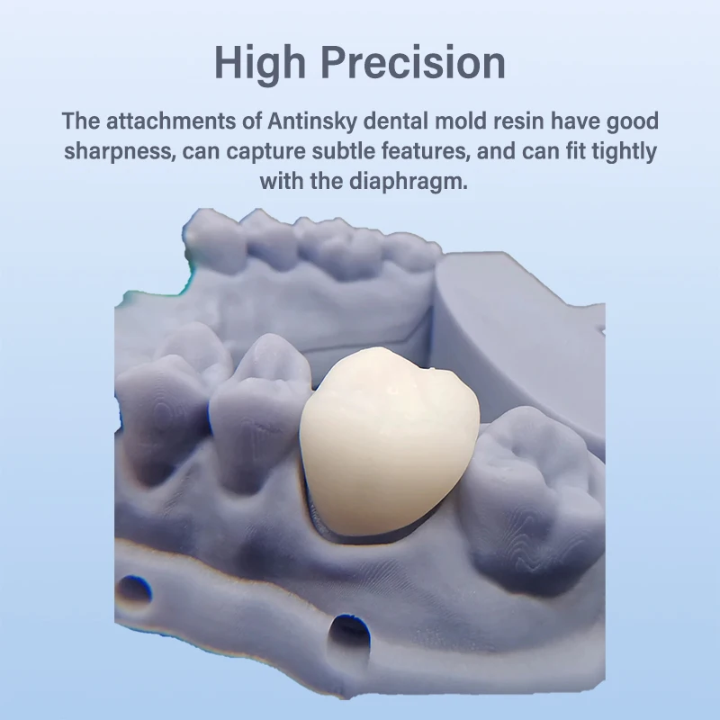 Lodden 3D-Drucker-Harzflüssigk – Dental 3D Printer Resin Bewertung und Preis