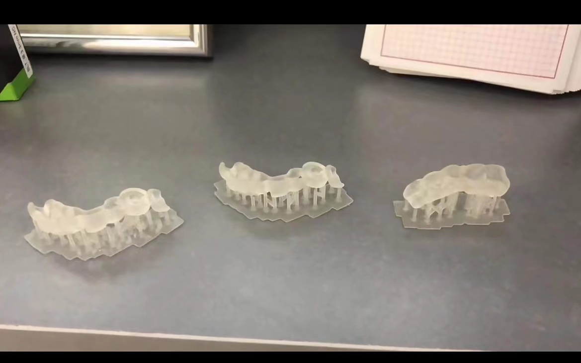 Harz Dental 3D Drucker Pflanzf – Dental 3D Printer Resin Bewertung und Preis