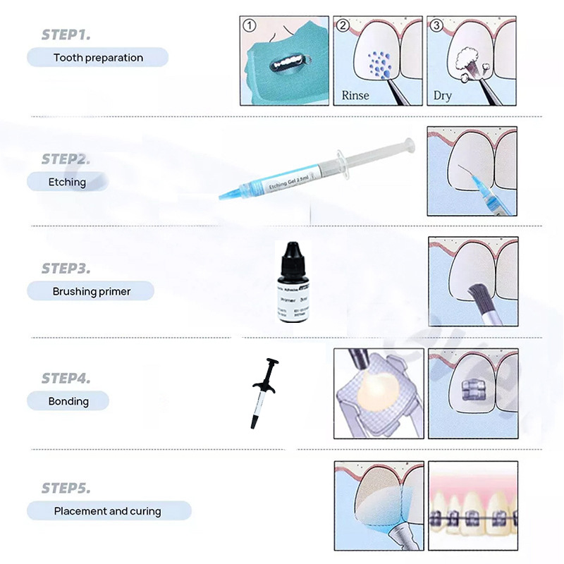 Dental Licht Härtende Kieferor – Dental Impression Material Kit Bewertung und Preis